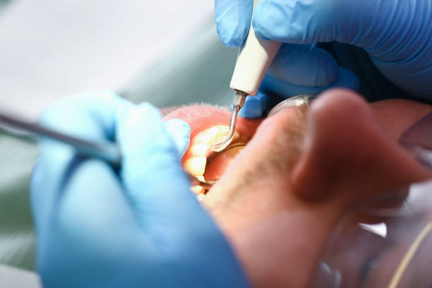 Best Teeth Whitening  in Shelby, MI